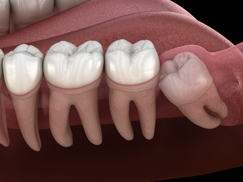 Precision Oral Surgery - Fredericksburg and Chesterfield VA